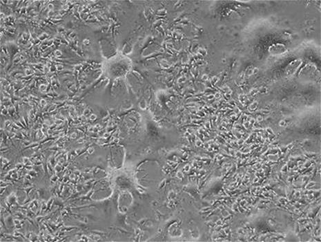 Fused mammalian cells