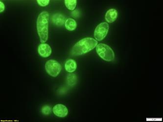 Candida albicans yeast cells showing vacuoles in green fluorescence