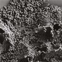 Biofilm Yeast Biofilm Yeast