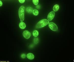 Candida albicans yeast cells showing vacuoles in green fluorescence