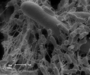 polymicrobiol biofilm