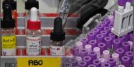 webpage foto hematologie-190