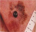 Description: Dermatology Keywords: Dermatology, Main Page